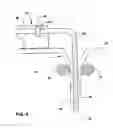 Fig. 05 - Flexible tube sensor for sensing urinary sphincter pressure