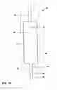 Fig. 10 - Flexible tube sensor for sensing urinary sphincter pressure