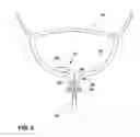 Fig. 03 - Implantable optical pressure sensor for sensing urinary sphincter pressure