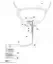 Fig. 07 - Implantable optical pressure sensor for sensing urinary sphincter pressure