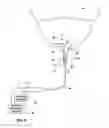 Fig. 08 - Multi-tube sensor for sensing urinary sphincter and urethral pressure