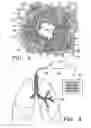 Fig. 04 - Control system and process for application of energy to airway walls and other mediums