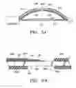 Fig. 06 - Control system and process for application of energy to airway walls and other mediums
