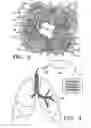 Fig. 04 - Control system and process for application of energy to airway walls and other mediums