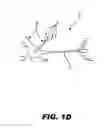 Fig. 05 - Methods and systems for treating autism by decreasing neural activity within the brain