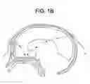 Fig. 03 - Method of removing deleterious charged molecules from brain tissue