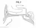 Fig. 06 - Method of removing deleterious charged molecules from brain tissue