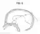Fig. 09 - Method of removing deleterious charged molecules from brain tissue