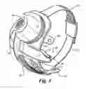 Fig. 02 - Retinal prosthesis and method of manufacturing a retinal prosthesis