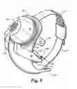 Fig. 07 - Retinal prosthesis and method of manufacturing a retinal prosthesis