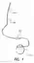 Fig. 02 - Compliant stimulating electrodes and leads and methods of manufacture and use