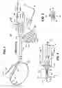 Fig. 04 - Guide catheters for accessing cardiac sites