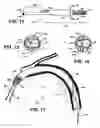 Fig. 08 - Guide catheters for accessing cardiac sites