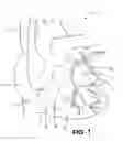 Fig. 02 - Guide catheters for accessing cardiac sites