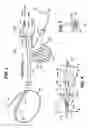 Fig. 04 - Guide catheters for accessing cardiac sites