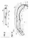 Fig. 07 - Guide catheters for accessing cardiac sites