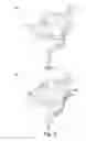 Fig. 03 - Cardiac electrode anchoring system