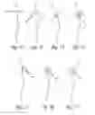 Fig. 08 - Cardiac electrode anchoring system