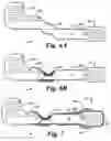 Fig. 07 - Flexible circuit electrode array