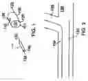 Fig. 02 - System and method for delivering a bifurcated stent