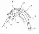 Fig. 01 - Delivery system comprising a self expanding stent
