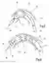 Fig. 05 - Delivery system comprising a self expanding stent