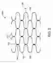 Fig. 03 - Use of platinum group metals in vascular devices and method of texturing platinum group metals