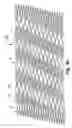 Fig. 09 - Flexible stent