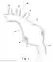 Fig. 02 - Methods and apparatus for treatment of aneurysms adjacent branch arteries