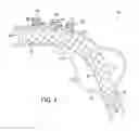 Fig. 07 - Methods and apparatus for treatment of aneurysms adjacent branch arteries