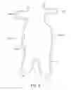 Fig. 08 - Methods and apparatus for treatment of aneurysms adjacent branch arteries
