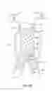 Fig. 10 - Methods and apparatus for treatment of aneurysms adjacent branch arteries