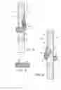 Fig. 03 - Branched vessel endoluminal device with fenestration