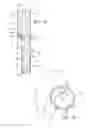 Fig. 07 - Branched vessel endoluminal device with fenestration