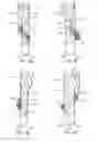 Fig. 08 - Branched vessel endoluminal device with fenestration