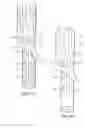 Fig. 09 - Branched vessel endoluminal device with fenestration