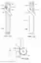 Fig. 12 - Branched vessel endoluminal device with fenestration