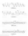 Fig. 20 - Branched vessel endoluminal device with fenestration