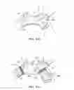Fig. 32 - Branched vessel endoluminal device with fenestration