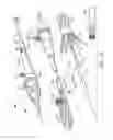Fig. 40 - Branched vessel endoluminal device with fenestration