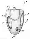 Fig. 01 - System and method for sizing a heart for treating congestive heart failure