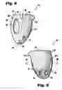 Fig. 04 - System and method for sizing a heart for treating congestive heart failure