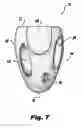 Fig. 05 - System and method for sizing a heart for treating congestive heart failure