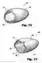 Fig. 11 - System and method for sizing a heart for treating congestive heart failure