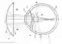 Fig. 01 - System for enlarging a retinal image