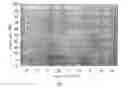 Fig. 07 - System for enlarging a retinal image