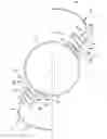 Fig. 01 - Accommodating intraocular lens implant