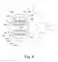 Fig. 04 - Expandable intervertebral implant and associated instrumentation