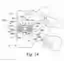 Fig. 07 - Expandable intervertebral implant and associated instrumentation