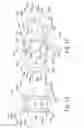 Fig. 06 - Expandable spinal implant and associated instrumentation